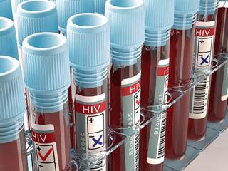 There is evidence that HIV might have spread from its origins in the US to the rest of the world. There is evidence that HIV might have spread from its origins in the US to the rest of the world.