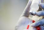 Botulinum toxin may be safe and effective for overactive bladder Botulinum toxin may be safe and effective for overactive bladder