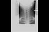 Ortho Dx: Does this patient's pain originate at the neck? Ortho Dx: Does this patient's pain originate at the neck?