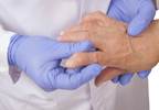 Hand osteoarthritis will affect about 40% of people Hand osteoarthritis will affect about 40% of people