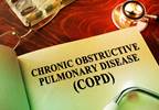 NIH creates COPD National Action Plan NIH creates COPD National Action Plan