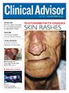 July 2017 Issue of Clinical Advisor July 2017 Issue of Clinical Advisor