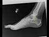 Ortho Dx: Can you identify this structure? Ortho Dx: Can you identify this structure?