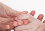 <i>Candida</i> antigen safe and effective treatment for common warts <i>Candida</i> antigen safe and effective treatment for common warts