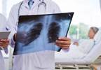 Diagnosis of hospital-acquired pneumonia still a challenge Diagnosis of hospital-acquired pneumonia still a challenge