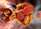 About 5% of patients with unprovoked VTE develop occult cancer About 5% of patients with unprovoked VTE develop occult cancer