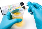 FDA approves Vabomere for UTI treatment FDA approves Vabomere for UTI treatment