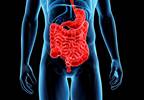 Colon cleansing regimens in inflammatory bowel disease: a review Colon cleansing regimens in inflammatory bowel disease: a review