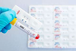 The outbreak of hepatitis A in San Diego has led to 15 deaths and 279 hospitalizations. The outbreak of hepatitis A in San Diego has led to 15 deaths and 279 hospitalizations.