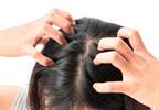 Secukinumab well-tolerated in patients with scalp psoriasis Secukinumab well-tolerated in patients with scalp psoriasis