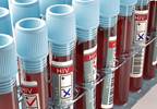 Notification rates of HIV diagnoses increased in 16 European countries Notification rates of HIV diagnoses increased in 16 European countries