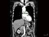 Image of the Week: What is the threshold for surgical intervention? Image of the Week: What is the threshold for surgical intervention?