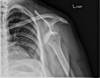 Ortho Dx: A shoulder injury after a mixed martial arts competition Ortho Dx: A shoulder injury after a mixed martial arts competition