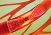 Independent Predictors of VTE Identified in Systemic Sclerosis Independent Predictors of VTE Identified in Systemic Sclerosis