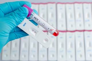 The AASLD and IDSA have added updates to the hepatitis C guidelines to include kidney transplant, pregnant, and pediatric patients. The AASLD and IDSA have added updates to the hepatitis C guidelines to include kidney transplant, pregnant, and pediatric patients.