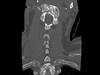 Ortho Dx: Neck pain after a motor vehicle accident Ortho Dx: Neck pain after a motor vehicle accident