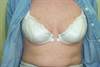 Derm Dx: Sudden onset of itchy, reddened macules Derm Dx: Sudden onset of itchy, reddened macules