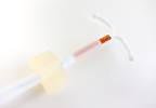 ACOG issues recommendations for long-acting reversible contraception ACOG issues recommendations for long-acting reversible contraception