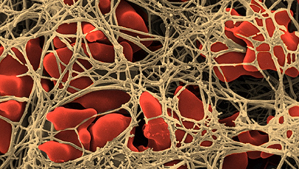 blood cell fragments used to clot blood are called