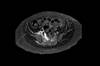 Ortho Dx: Treatment for lower back and buttock pain Ortho Dx: Treatment for lower back and buttock pain