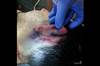Image of the Week: Injuries after a physical altercation Image of the Week: Injuries after a physical altercation