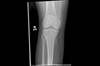 Ortho Dx: What is the best treatment for this knee injury? Ortho Dx: What is the best treatment for this knee injury?