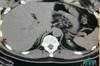 Image of the Week: What is causing this patient's resistant hypertension? Image of the Week: What is causing this patient's resistant hypertension?