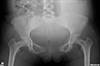 Ortho Dx: Severe pelvic pain after childbirth Ortho Dx: Severe pelvic pain after childbirth