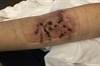 Derm Dx: Pink plaques and crusting ulcerations Derm Dx: Pink plaques and crusting ulcerations