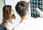 Mild cognitive impairment: a practice guideline update Mild cognitive impairment: a practice guideline update