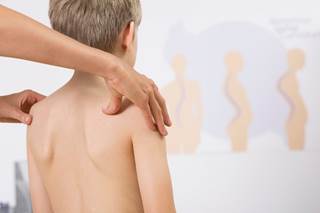The USPSTF has updated its recommendations on screening for idiopathic scoliosis in asymptomatic adolescents. The USPSTF has updated its recommendations on screening for idiopathic scoliosis in asymptomatic adolescents.
