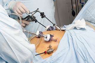 Does congestive heart failure cause weight loss image 9