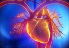 Case Study: Lower extremity edema and heart failure in a middle-aged woman Case Study: Lower extremity edema and heart failure in a middle-aged woman