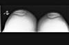 Ortho Dx: Swelling and pain in the knee Ortho Dx: Swelling and pain in the knee