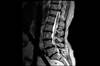 Ortho Dx: Back pain and loss of bladder control Ortho Dx: Back pain and loss of bladder control