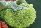 Managing acute UTIs in postmenopausal women Managing acute UTIs in postmenopausal women