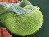 Managing acute UTIs in postmenopausal women Managing acute UTIs in postmenopausal women