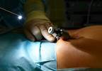 Laparoscopic hysterectomies increased in popularity from 2010 to 2013 Laparoscopic hysterectomies increased in popularity from 2010 to 2013