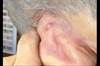 Derm Dx: A growth behind the ear Derm Dx: A growth behind the ear
