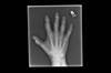 Ortho Dx: A painful ring finger Ortho Dx: A painful ring finger