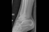 Ortho Dx: Right lower extremity pain Ortho Dx: Right lower extremity pain