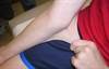 Derm Dx: Elastic skin and scattered scars Derm Dx: Elastic skin and scattered scars