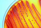 Antibiotic-Resistant Bacteria Found in 221 US Healthcare Facilities Antibiotic-Resistant Bacteria Found in 221 US Healthcare Facilities