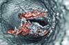 Stat consult: Sudden cardiac death Stat consult: Sudden cardiac death