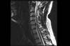 Ortho Dx: Radiating right arm pain Ortho Dx: Radiating right arm pain