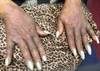 Derm Dx: An itchy rash on the hands Derm Dx: An itchy rash on the hands
