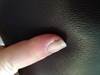 Derm Dx: Pain at the base of a fingernail Derm Dx: Pain at the base of a fingernail