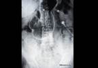 Case Study: Sudden Abdominal Pain Case Study: Sudden Abdominal Pain