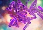 CDC Issues Update for Resistant Shigella Infections CDC Issues Update for Resistant Shigella Infections