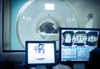 Quantification of Prevalence, Outcomes of Incidental Imaging Abnormalities Quantification of Prevalence, Outcomes of Incidental Imaging Abnormalities